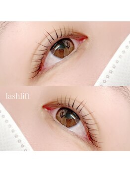 ベルシア(BELXIA)/ラッシュリフト