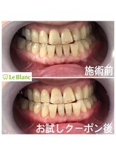 ルブラン 奈良店(Le Blanc)/黄ばみはマイナスイメージに。