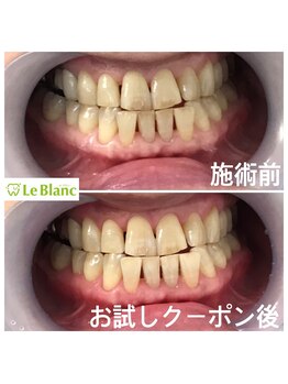 ルブラン 奈良店(Le Blanc)/黄ばみはマイナスイメージに。