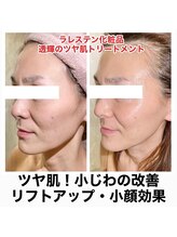 エリュクス(et Luxe)/韓国女優のツヤ肌に