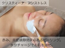 クレスト(CLEST.)/クリスティーナ/アンストレス