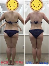 エスティフル 狭山店(ESTIFUL)/[痩身エステ]Before/After