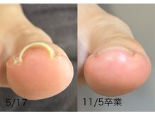 ロンディネ(Rondine)の雰囲気（酷くなる前からケアをしましょう！）