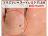 【シミが気になり始めた方】プラズマ＋お試しシミケア15分 初回7500円