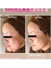 ラセンシアアンジュ(Lasencia Ange)/これが【幹細胞培養上清】の力！