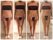 サロン ド カシェット 銀座/お客様のビフォーアフター例