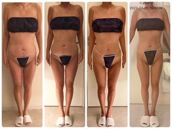 サロン ド カシェット 銀座/お客様のビフォーアフター例