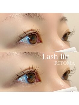 リトマ(RITOMA)/ラッシュリフト