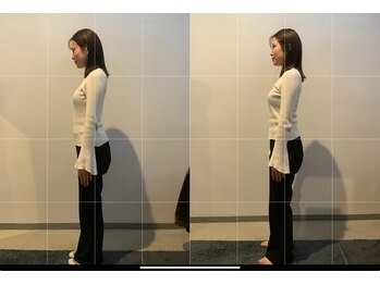 小顔矯正整体サロン イクサス(IxAS)/初回での<before&after>