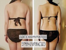 マナ(mana)の雰囲気（猫背・巻き肩・肩甲骨・二の腕◎自信のブライダル痩身ご紹介多数）