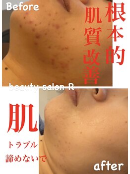 ビューティサロン アール(R)/お悩みにしっかりアプローチ