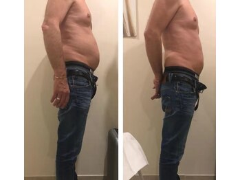 アモ(AMO)/TM3#脂肪冷却#痩身#ダイエット