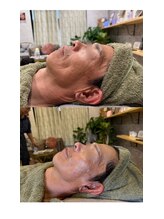 マシェリ(MA CHERIE)/Ｅライト光フェイシャル