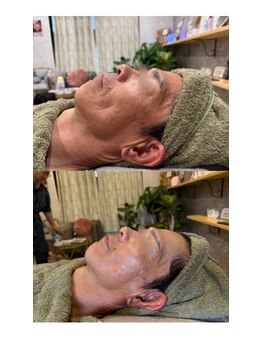 マシェリ(MA CHERIE)/Eライト光フェイシャル