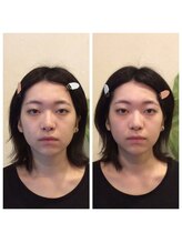 健幸堂 本店/小顔矯正1回