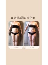 パーソナルデトックスサロン エヌ(N)/【くびれ職人】在籍サロン