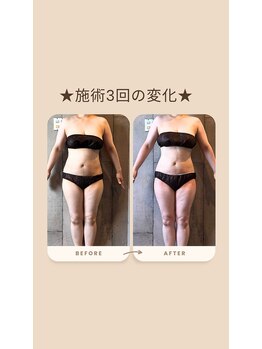 パーソナルデトックスサロン エヌ(N)/【くびれ職人】在籍サロン