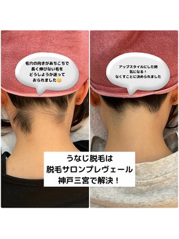 プレヴェール 神戸三宮/うなじ脱毛