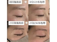 ブリリア(Brillia)の雰囲気（細かいライン調整も◎美容電気脱毛で美しい眉が長持ち！）