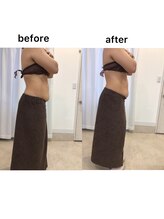 ジョワイユ(Joyeux)/腸の位置でお腹は変わる