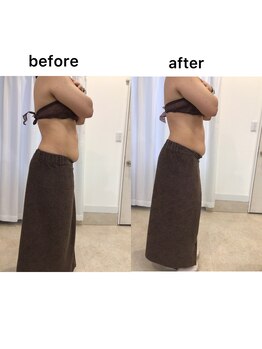 ジョワイユ(Joyeux)/腸の位置でお腹は変わる