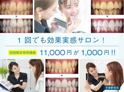 ホワイトニングショップ 京都駅前店の写真