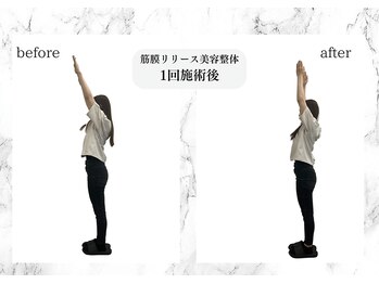 トキ(TOKI)/筋膜リリース美容整体 施術後