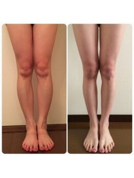 骨盤ストレッチ整体 b/美脚矯正★変化写真