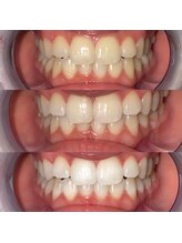 ライトビューティー 池袋店(LightBeauty)/症例写真