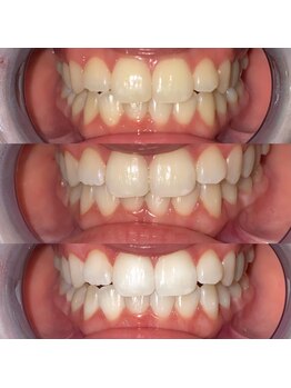 ライトビューティー 池袋店(LightBeauty)/症例写真