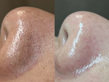 フレーズ(fraise)/