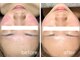 トータルビューティーサロン ティティ(Titi)の写真