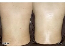 アネル 浦添店(anel)/