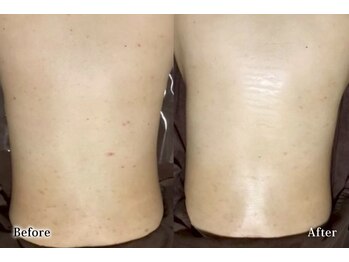 アネル 浦添店(anel)/