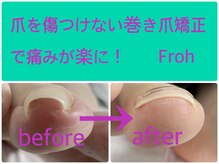 フロー(Froh)