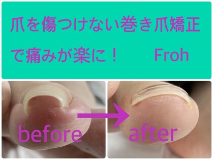 フロー(Froh)の写真