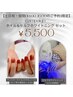 『土日祝:昼間(10時-16時)限定☆』ハンドネイル+セルフホワイトニングSET