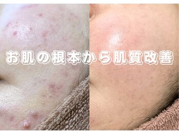 ヴィーダ 渋谷松濤(ViDA)