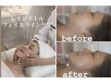 ブリリアントスマイル/レモンボトル