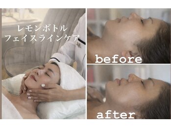 ブリリアントスマイル/レモンボトル