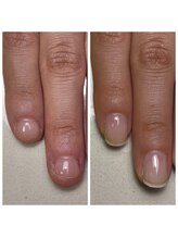 リヒネイル(Rihi.nail)/自爪育成