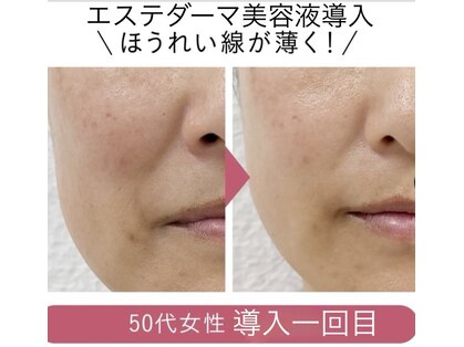 キワミ サーティスリー(kiwami33)の写真