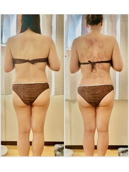 ビオーム 月と華(Bioom)/４回目でこの変化！３.１キロ減