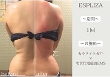エスプライザ 横浜綱島店(ESPLIZA)