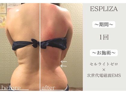エスプライザ 横浜綱島店(ESPLIZA)の写真
