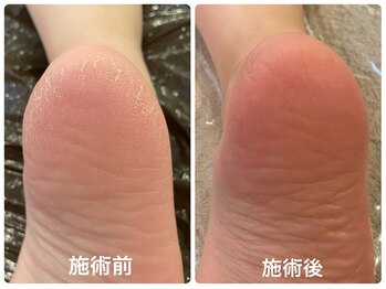 クロエクロウ(chloe'crow)/