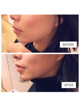 リラマ(Relama)/当店メインメニュー