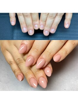 クリーク(CREEK)/深爪補正☆自爪育成☆ネイルケア