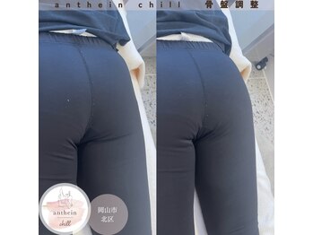 アンテイン チル(anthein chill)/骨盤調整