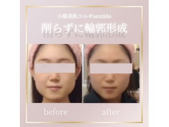 小顔美肌コルギ専門店 センティード 吉祥寺(Sentido)/